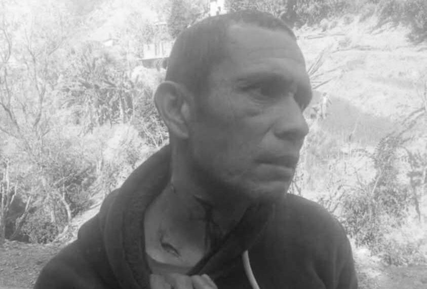 बैतडीमा बाघको आक्रमणबाट एक जना घाइते