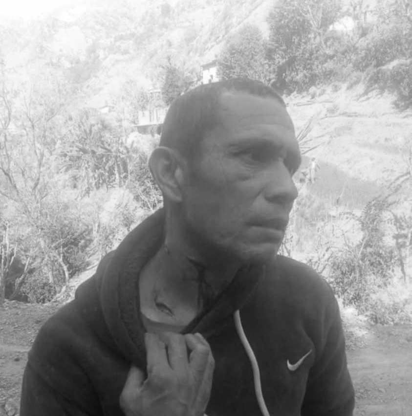 बैतडीमा बाघको आक्रमणबाट एक जना घाइते